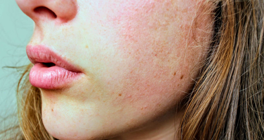 rubrica del benessere - pelle secca