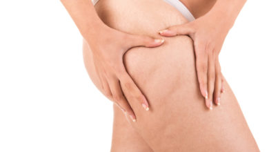 rubrica - benessere - cellulite