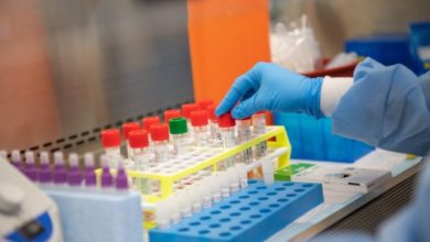 Covid Sicilia - 1 agosto